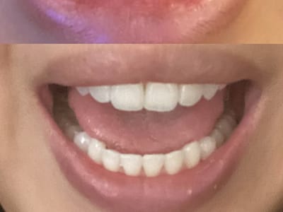 Salgra Dental - Dentist Pembroke Pines Invisalign Provider