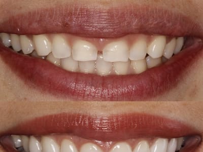 Sam Namdarian - Fresno Smile Makeovers, Premier Cosmetic Dentistry