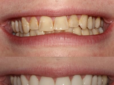 Sandi L Hamm DDS Cosmetic and Comprehensive Dentistry