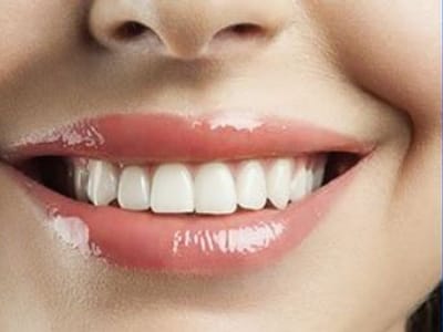 Saratoga Family Dentistry