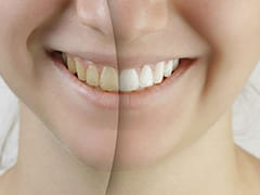 Saratoga Family Dentistry