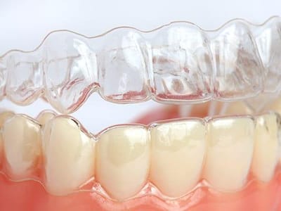 Schaumburg Dentistry