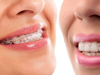 Schaumburg Dentistry