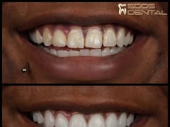 SDDS Dental - Implant, Veneer, Invisalign, and General Dentist