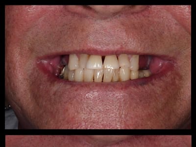 SDDS Dental - Implant, Veneer, Invisalign, and General Dentist