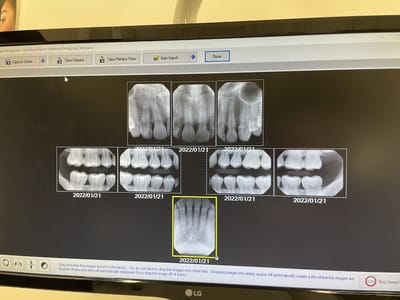 Seattle’s Downtown Dentist