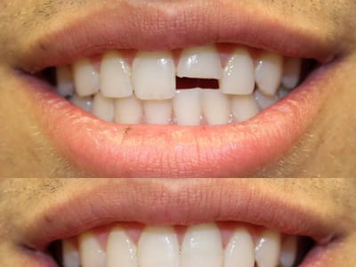 Serene Hills Dentistry