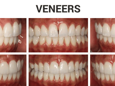 Shahbazyan DDS Cosmetic & General Dentistry