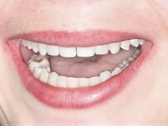 Shaun Janvier, D.M.D., Implant Cosmetic Family Dentistry