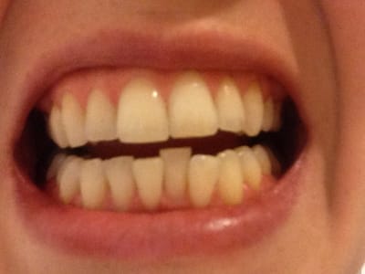 Shining Smiles Dentistry - Franklin Park