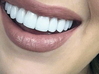 Shining Smiles Dentistry - Franklin Park