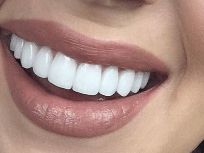 Shining Smiles Dentistry - Joliet