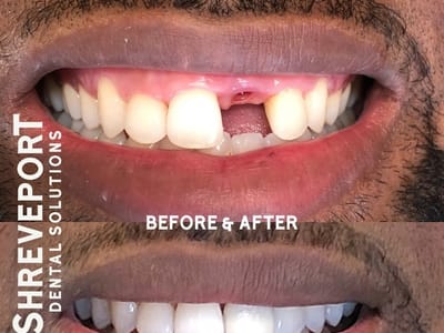 Shreveport Dental Solutions