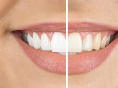 Silver Creek Dental Of Payson-Dr. Travis Storey