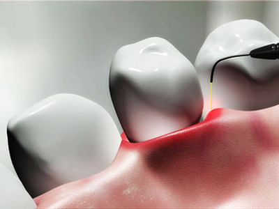 Silver Creek Dental Of Payson-Dr. Travis Storey