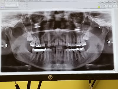 Silver Palms Dentistry