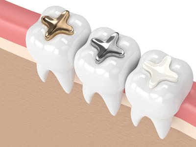 Singing River Dentistry