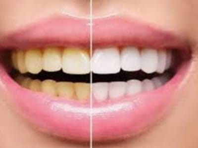 SK Dentistry, Dr. Scott Lee