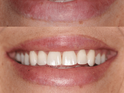 Smile Dailey General and Cosmetic Dentistry