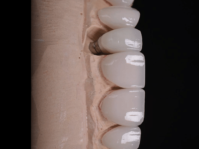 Smile Design Center | Dentist In Croton on Hudson NY | Implant Dentist