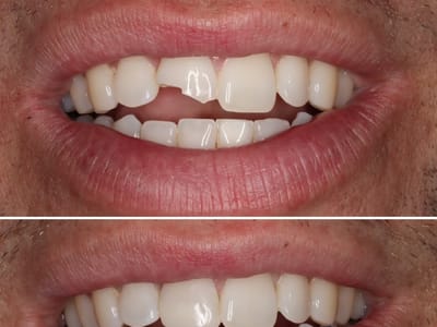 Smile Design Dentistry