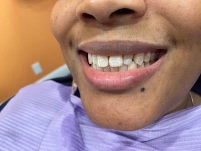 Smile Every Day Dentistry & Orthodontics of Plantation