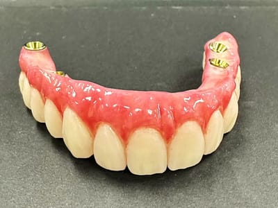 Smile For Success Dental Center - Tim Do Nha Khoa Lab Denture, Implant & Crown