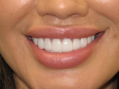 Smile Shapers Dental: Dr. Eva M. Goriee