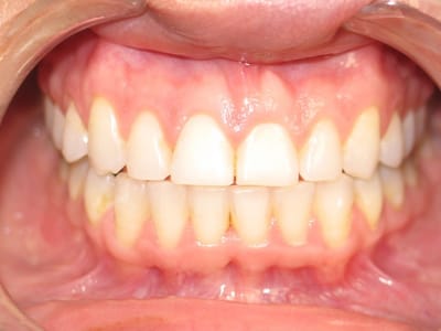 Smile Shapers Dental: Dr. Eva M. Goriee