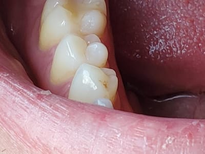 Smile Today - Dentist Scottsdale