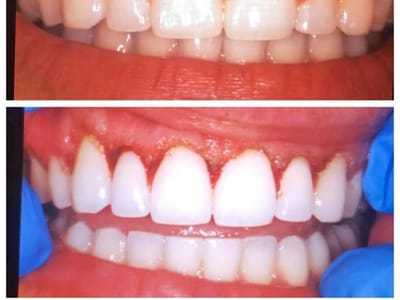 Smile Tucson Family Dentistry