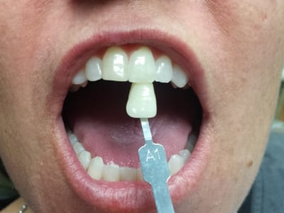 Smiles Ahead Family Dentistry