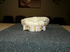 Smiles Family Dentistry & Cosmetics - Dr. W. Earl Harkless, DDS