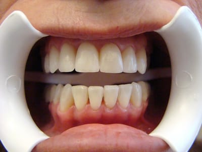 SmileUp Dentistry
