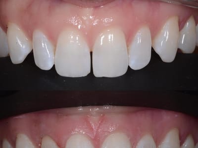 South Glens Falls Family Dentistry