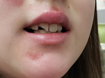 Spearmint Dental & Orthodontics - Wichita Falls