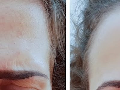 Springville Family Aesthetics & Dentistry - Dr. Bob Miklesh, D.D.S.