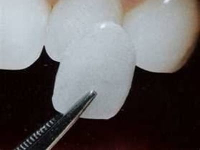 St Croix Valley Dentistry