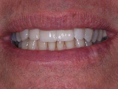 Stebbins Dental Studio