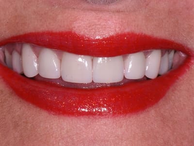 Stebbins Dental Studio