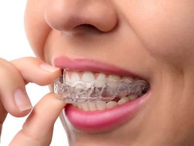 Stokke Family Dentistry PLLC