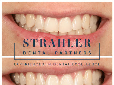 Strahler Dental Partners