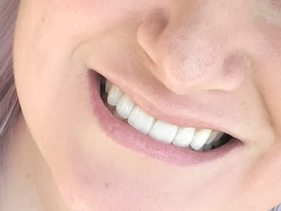 Stunning Smiles of Las Vegas