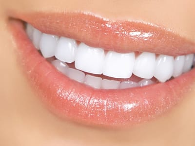 Summerlin Dental Solutions