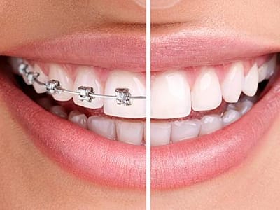 Sunrise Dental Walla Walla