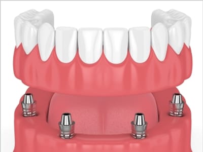 Sweet Smiles Family Dentistry