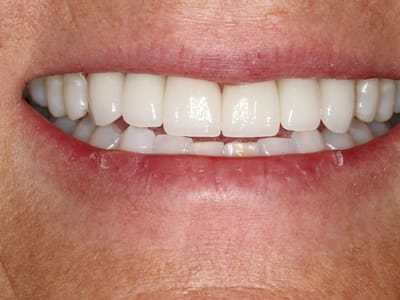 Telluride Center for Dentistry - Telluride Dental