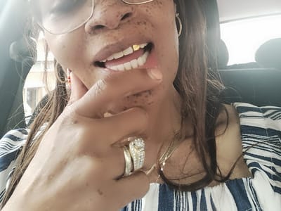 Terry J. Burpo, DMD Dentist Crane, MO