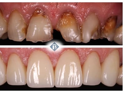 Tewksbury Dental Associates