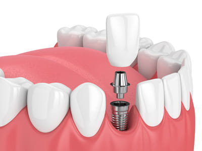 The Art of Dentistry - Kory Kirkegaard, DMD